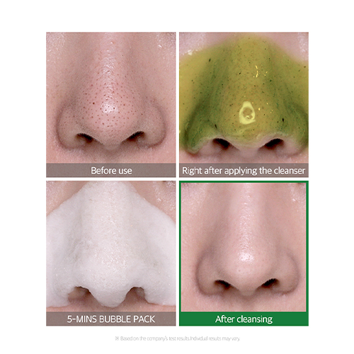 Bye Bye Blackhead 30 Days Miracle Green Tea Tox Bubble Cleanser (120g) - Image 3
